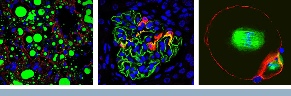 Imagerie cellulaire des laboratoires des chercheurs de l'IR-CUSM Peter Metrakos, M.D (gouttelettes lipidiques du foie), Tomoko Takano, M.D., Ph. D. (glomérule de rein de souris) et Rima Slim, Ph. D. en collaboration avec Teruko Taketo, PhD (ADN, fuseau et corps polaire de l'ovocyte de souris). Images réalisées à la Plateforme d’imagerie moléculaire de l’IR-CUSM.