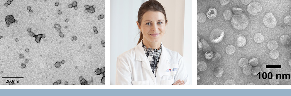 Un projet de Julia Burnier, Ph. D., se concentre sur la libération, par des nanoparticules lipidiques, de cellules spécifiques; il s’agit là d’un élément clé des médicaments fondés sur l’ARNm. (Images scientifiques réalisées par Thupten Tsering et Rubén López.)