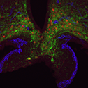 Hypothalamus murin après traitement à la leptine : la leptine induit la phosphorylation du facteur de transcription STAT3 (en rouge) dans les neurones récepteurs du leptine (en vert). Cellules endothéliales bleues du système vasculaire. Photo: Maia Kokoeva